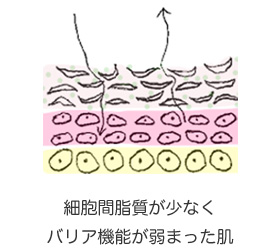 正常なバリア機能が保たれている肌